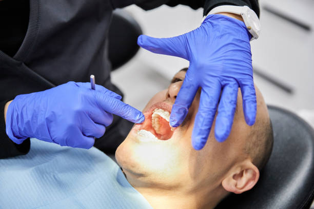 Best Walk-In Emergency Dental Services in Glenville, WV