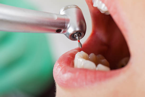 Best After-Hours Dental Care in Glenville, WV